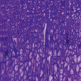 성장 호르몬 투여 세포